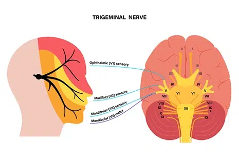 Illustrative diagram of the trigeminal nerve with labeled branches: Ophthalmic (V1), Maxillary (V2), and Mandibular (V3).