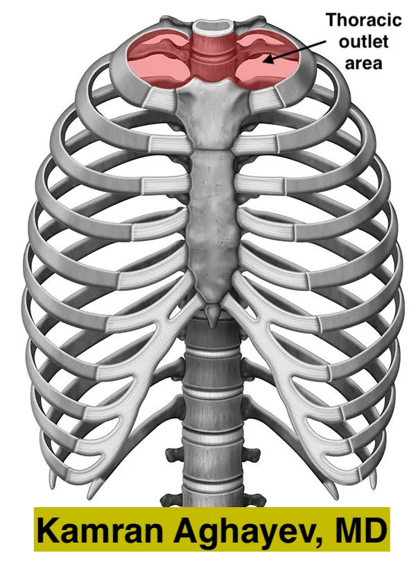 Thoracic outlet syndromes