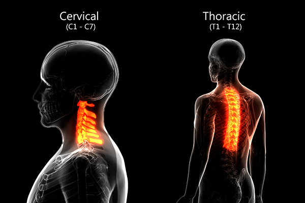 Illustration of cervical and thoracic spine most commonly affected by DISH disease.